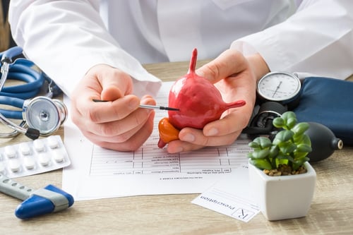 4 cosas que necesita saber sobre el cáncer de vejiga