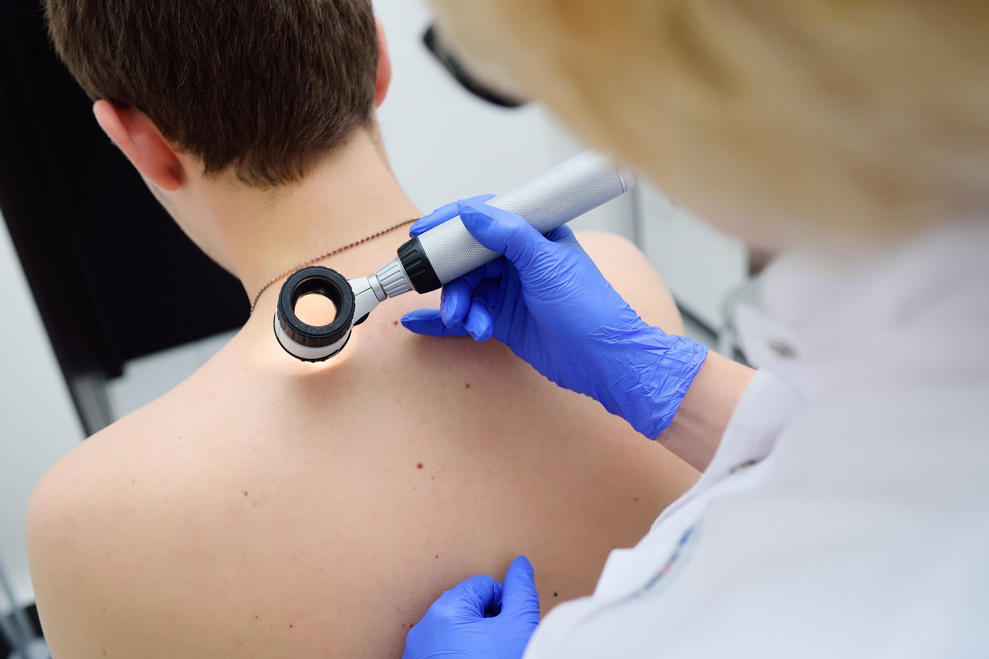 A healthcare provider is using a dermatoscope to perform a skin check on a patient’s back