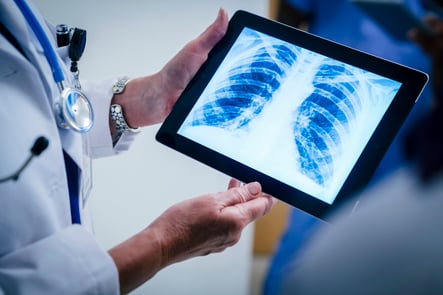 A physician holds a tablet with an image of lungs
