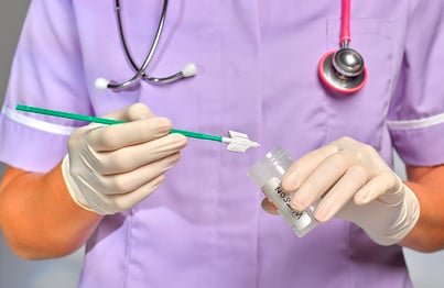 A provider places a test sample in a jar