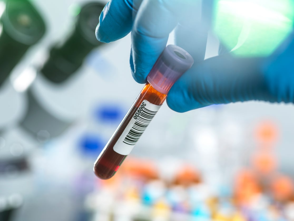 Anemia Workup Tests and When to Refer Anemia Patients