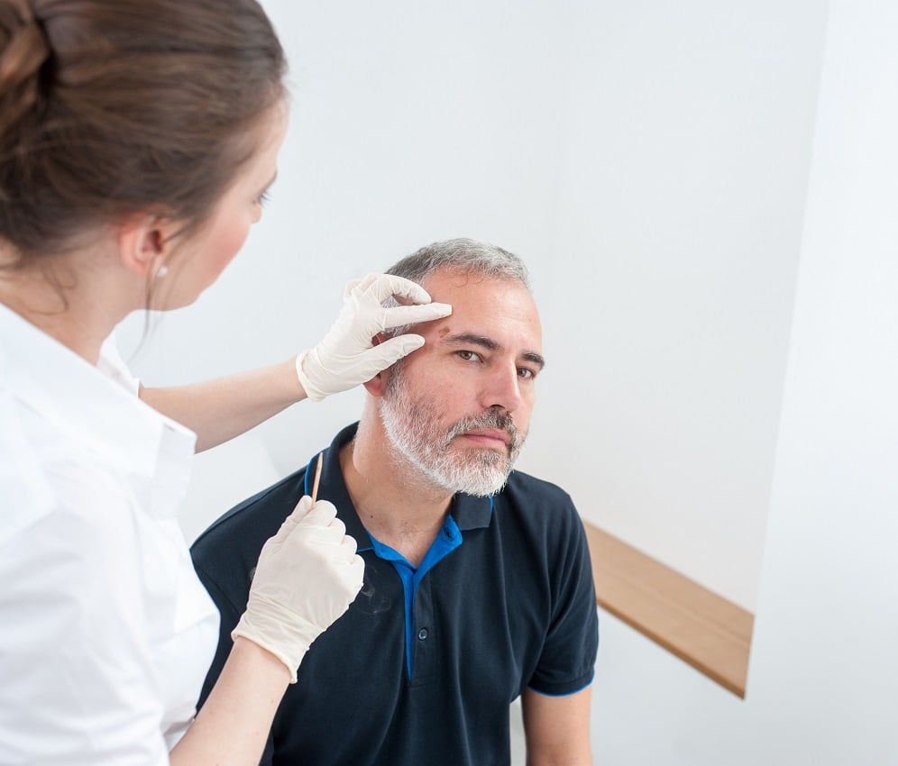 Cambiar el rumbo del melanoma metastásico con inmunoterapia