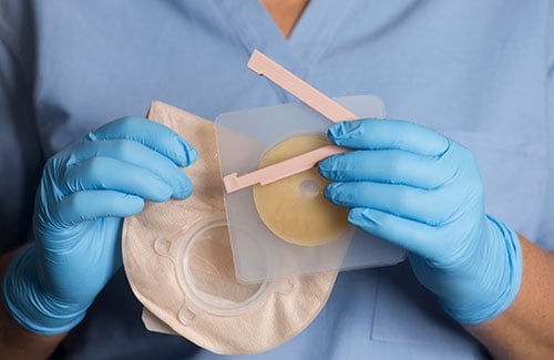 Colorectal-Cancer-Surgery-Options