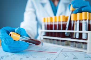 technician examines blood sample