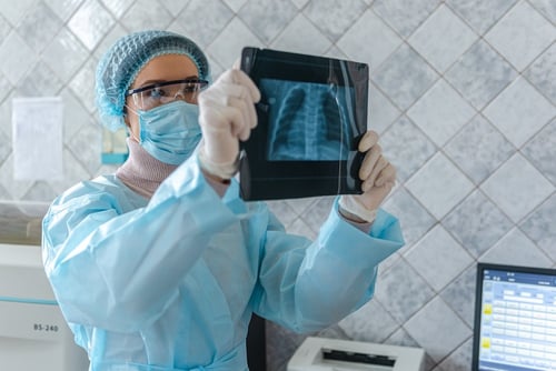 Cirugía del cáncer de pulmón: Qué esperar