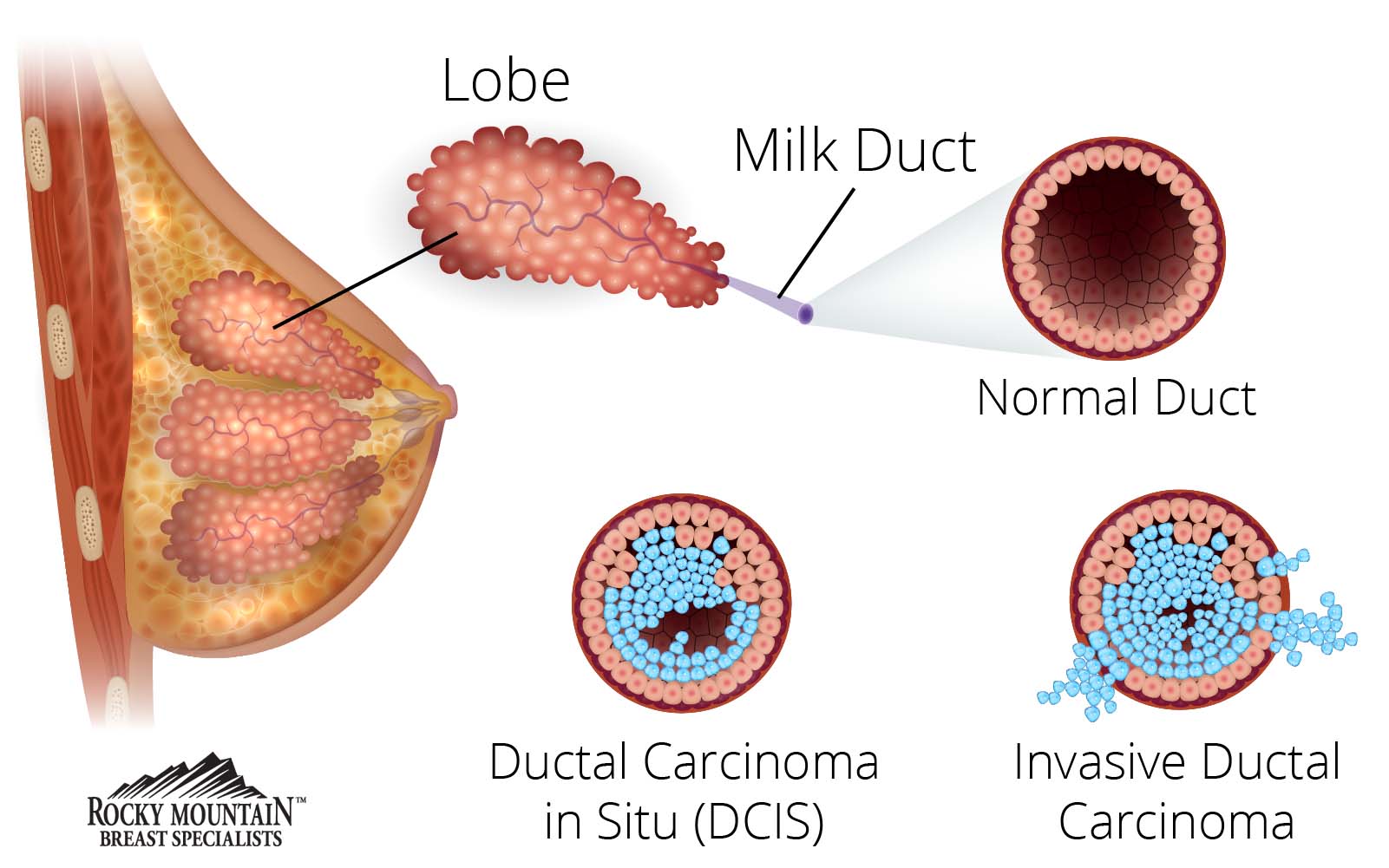 medical diagram of breast
