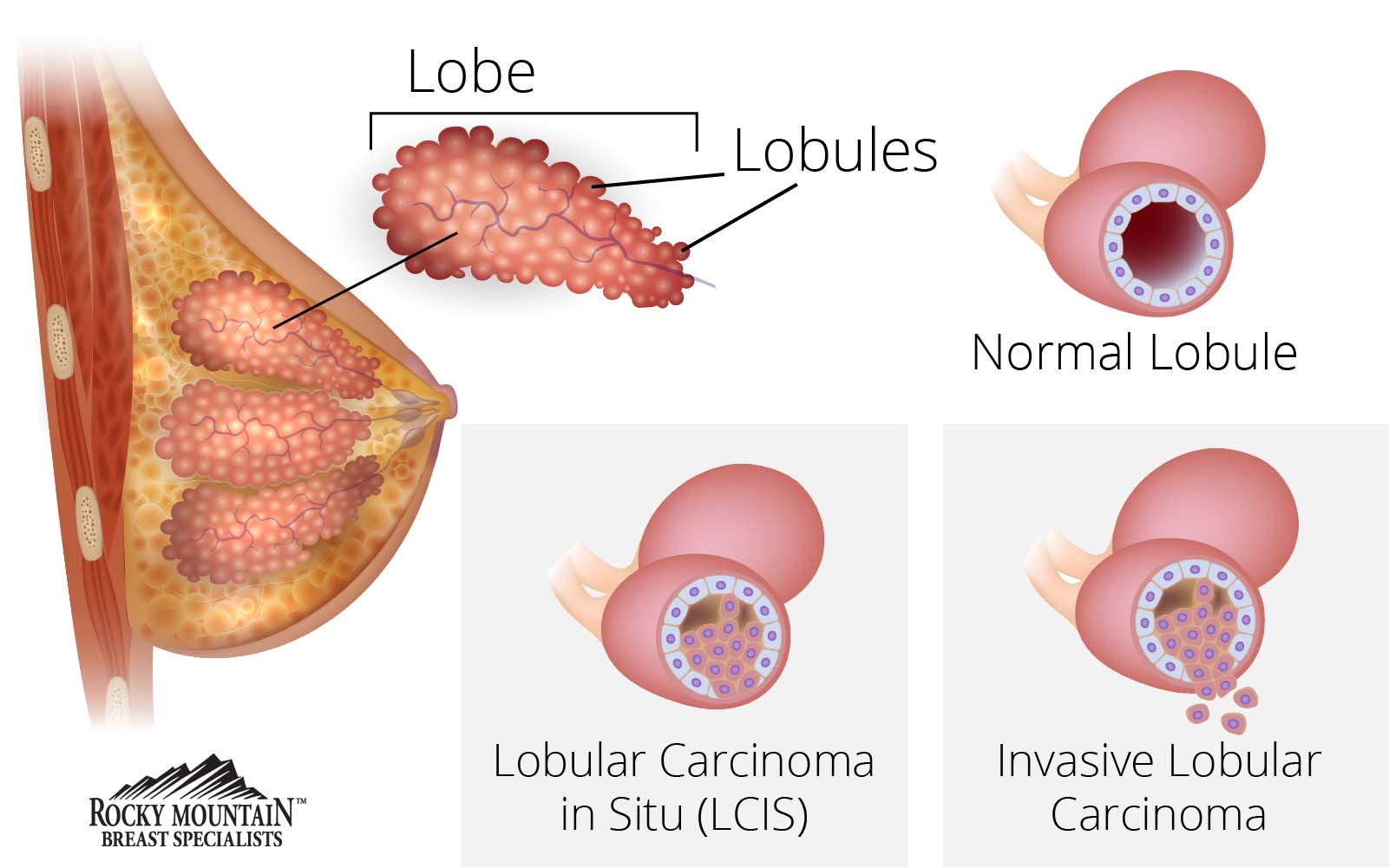 medical diagram of breast
