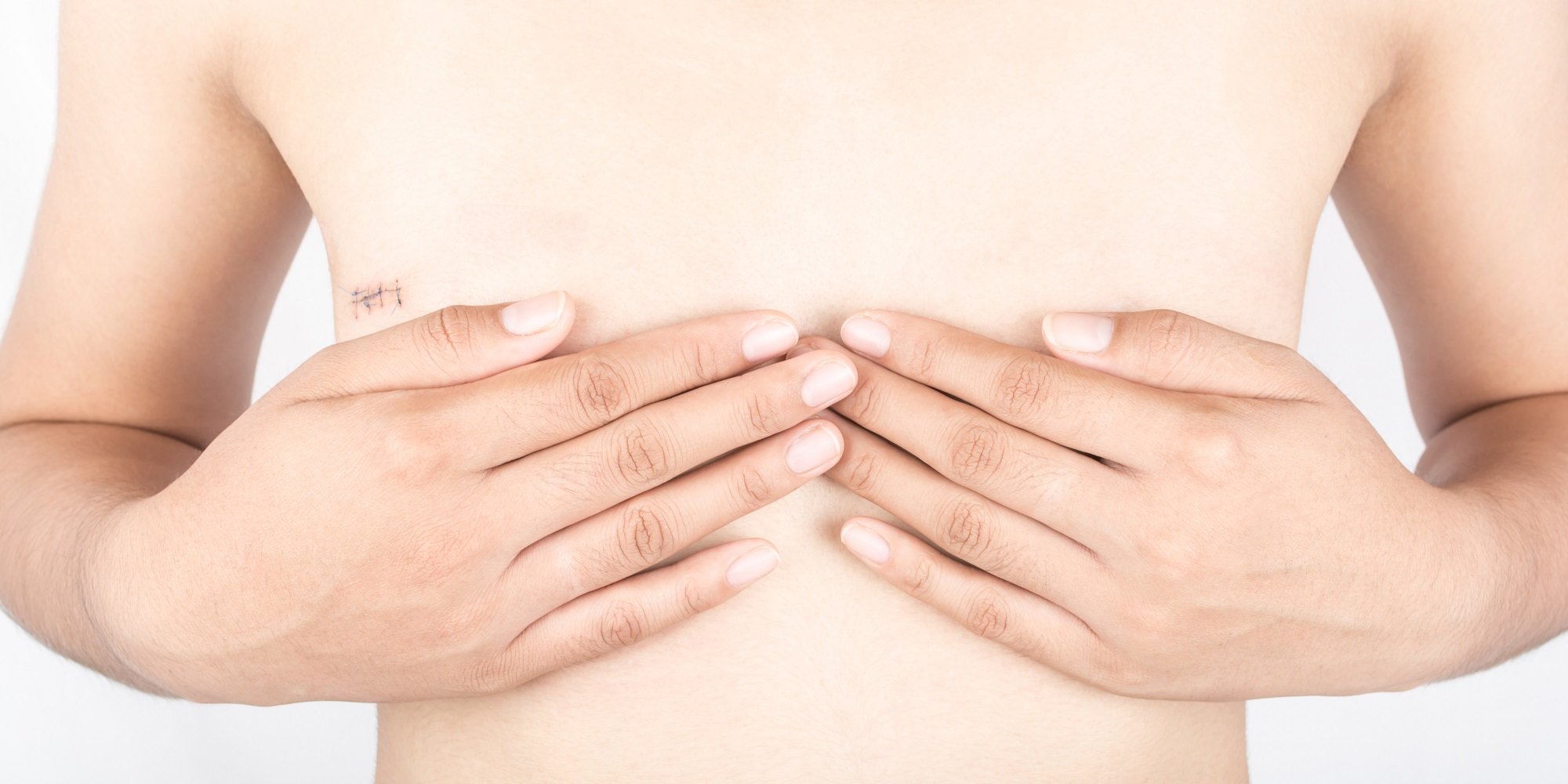 choosing breast reconstruction after a mastectomy