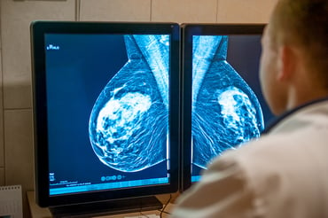Cribado del cáncer de mama: ¿Qué es la puntuación BI-RADS y qué significa para usted?