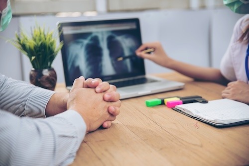 doctor reviewing lung cancer xrays