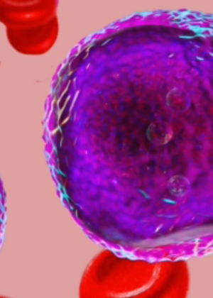 Frontline Treatment Discontinuation Is Higher in the Real World vs Clinical Trials in CLL/SLL