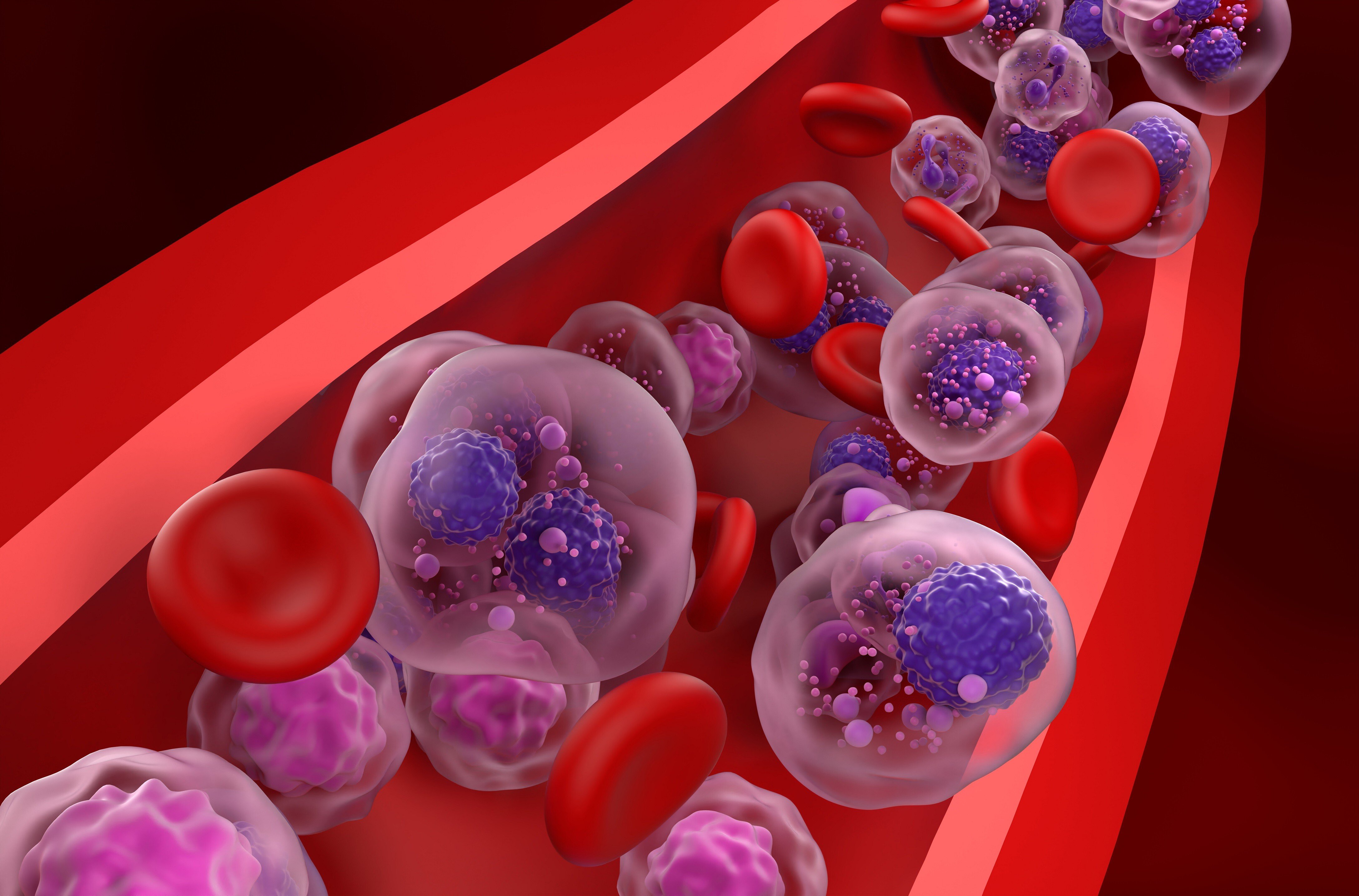 No CRS Seen in First 10 Patients in Teclistamab Pilot With Prophylactic Tocilizumab