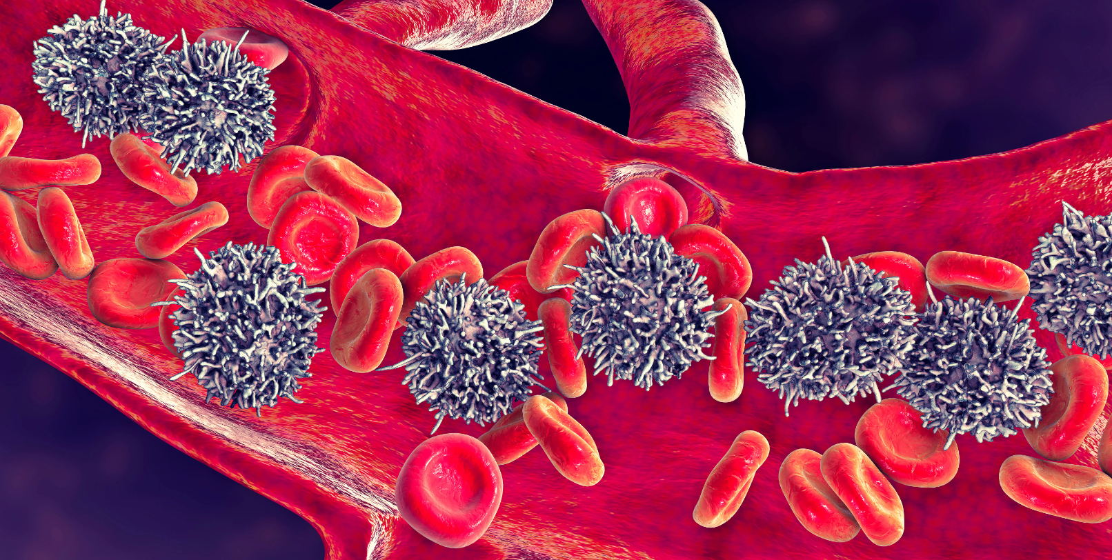 Community Cancer Practices Implement Venetoclax Protocols for CLL, But Gaps Remain