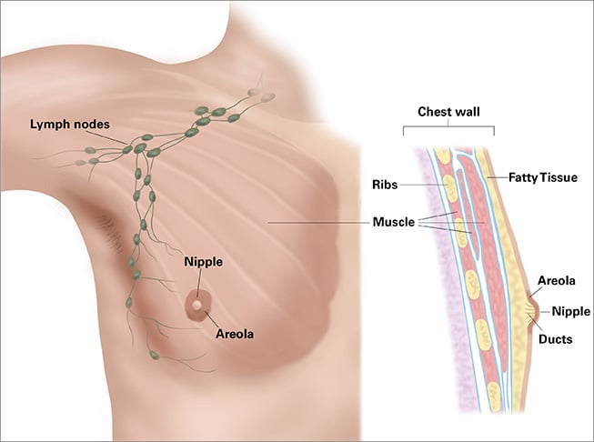 Male Breast Cancer: Awareness, Symptoms & Treatment
