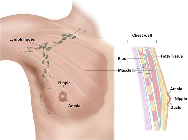 Cáncer de mama masculino: Conocimiento, síntomas y tratamiento